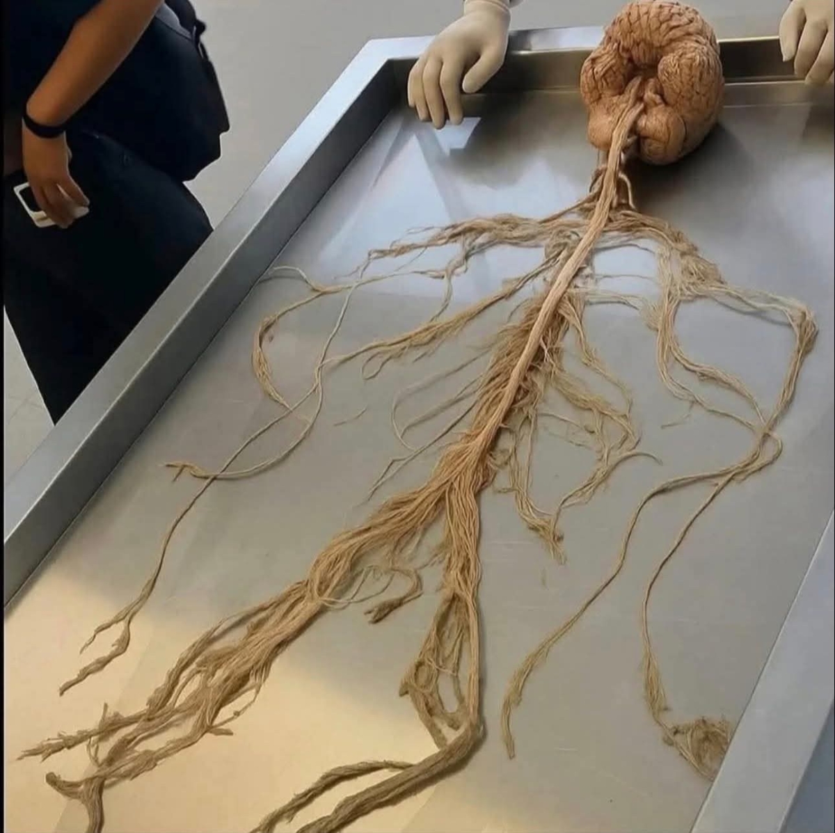 %e0%b8%99%e0%b8%b5%e0%b9%88%e0%b9%81%e0%b8%ab%e0%b8%a5%e0%b8%b0-%e0%b8%a3%e0%b8%b0%e0%b8%9a%e0%b8%9a%e0%b8%9b%e0%b8%a3%e0%b8%b0%e0%b8%aa%e0%b8%b2%e0%b8%97-%e0%b8%82%e0%b8%ad%e0%b8%87%e0%b8%a1